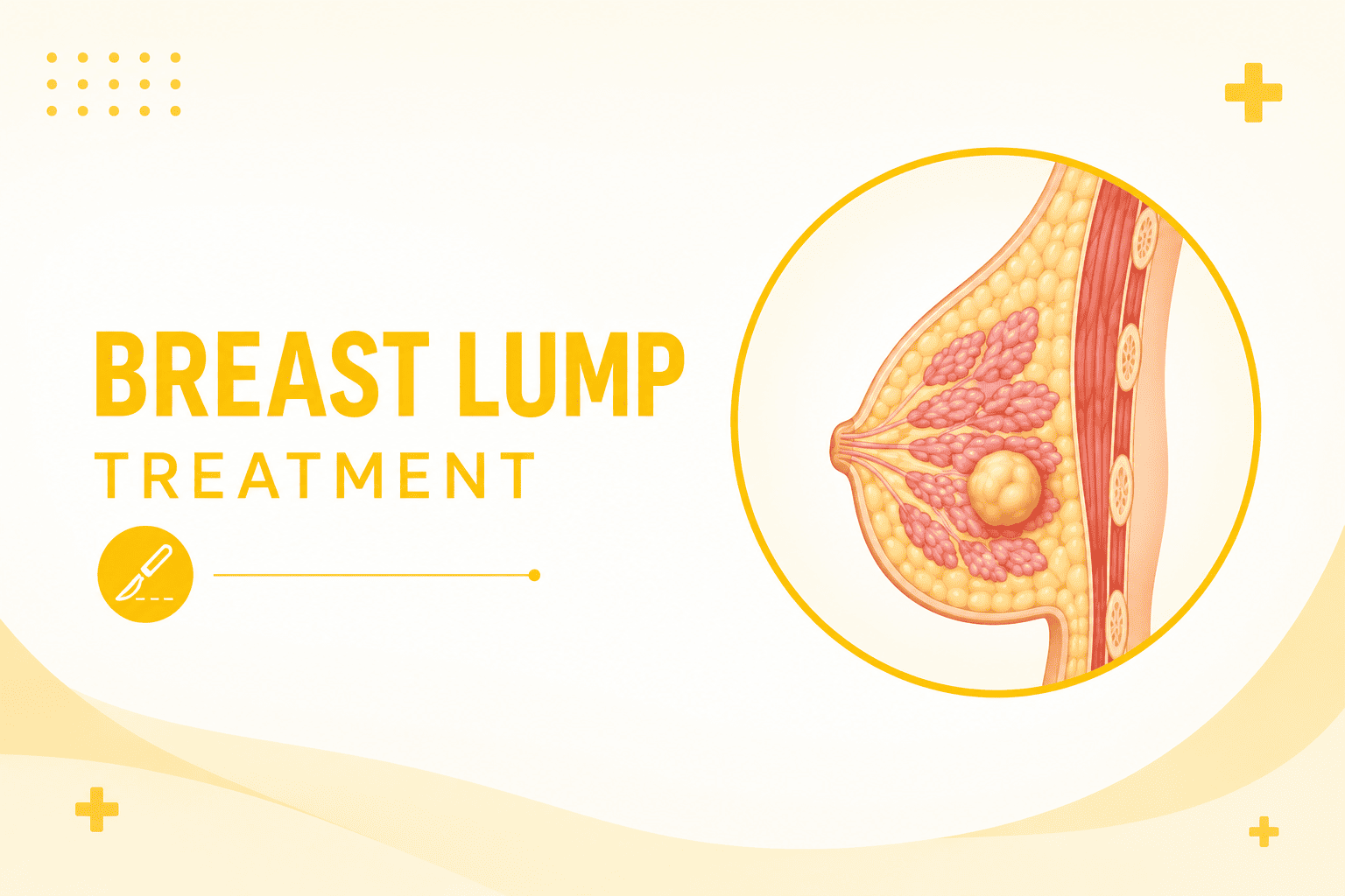 Best Doctor For Breast Lump Treatment in Andheri