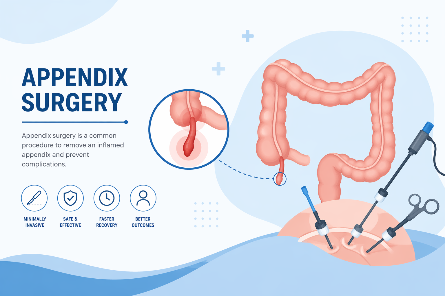 Best Doctor for Appendix Surgery in Andheri