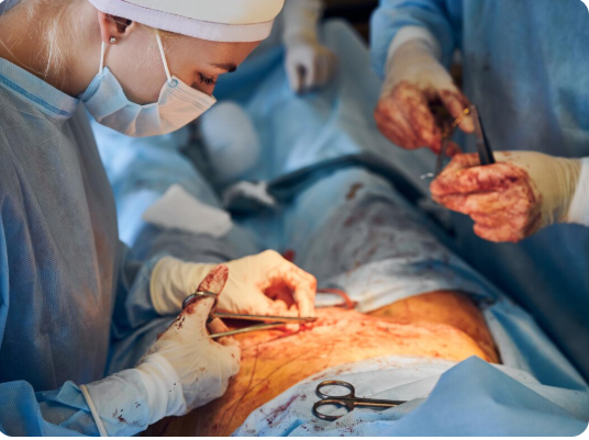 Best Gall Bladder Surgery in Andheri
